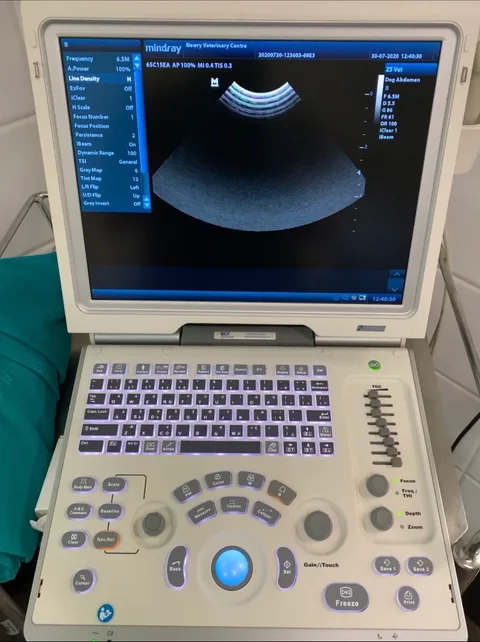 Portable ultrasound system with its display, keyboard and operating controls.